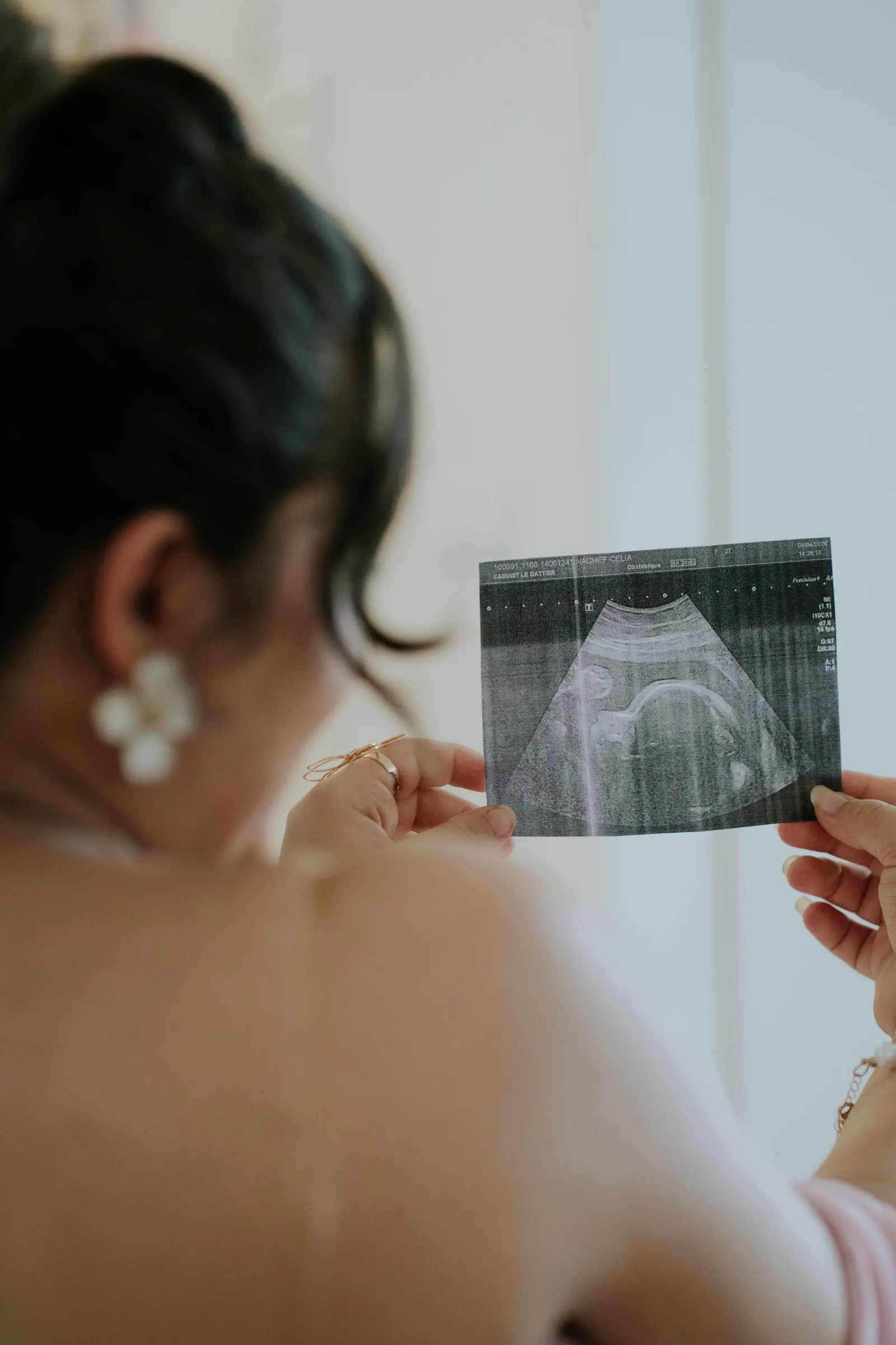 Une femme de dos regardant une échographie à contre-jour